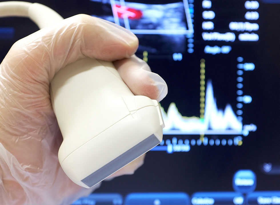 Zakažite Ultrazvuk – Dopler Pregled