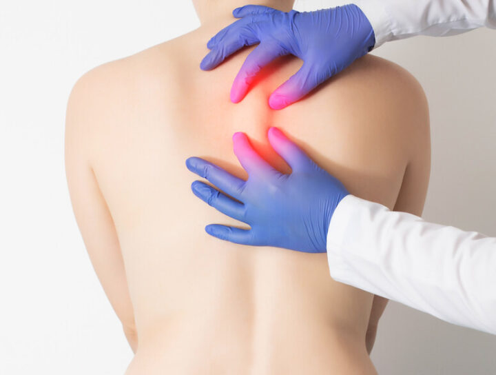 Hirurško uklanjanje ateroma